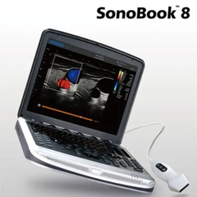 CHİSON SonoBook 8